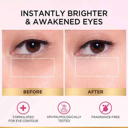 L'Oréal Paris, Glycolic Bright Eye Serum, with 3% (Glycolic Acid + Vitamin CG + Niacinamide], for Dark Circles and Under Eyes Brightening, 20ml