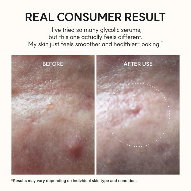 Eraser Shot Glycolic Acid Booster 30ml