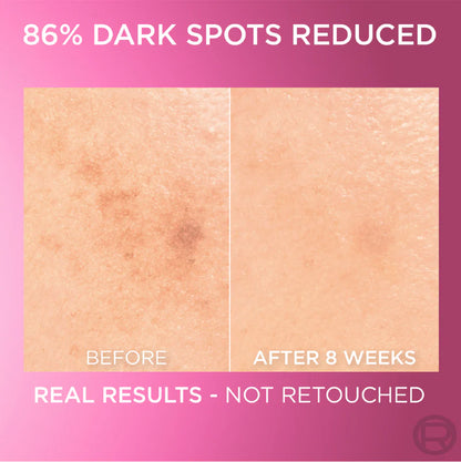 L’Oréal Paris, Glycolic Bright Face Serum, With 8% [Melasyl ™ + Glycolic Acid + Niacinamide], for Dark Spots and Brightening 30ml
